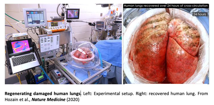 lung regeneration