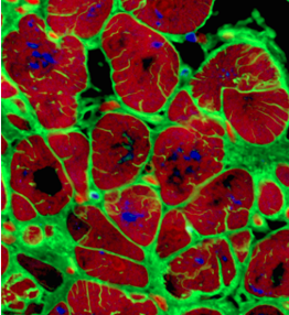 Cardiac tissue engineering